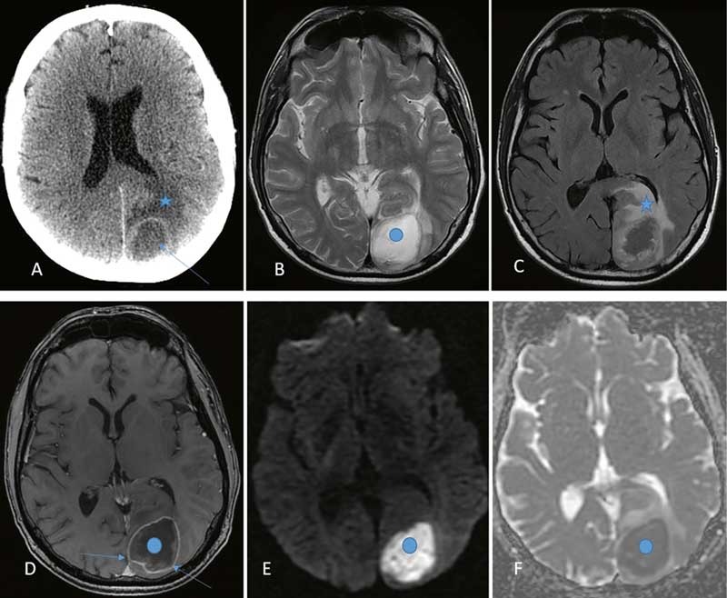 brain-scans