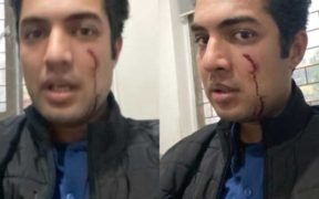 iqrar-ul-hassan-injured-in-attack-by-unknown-assailants