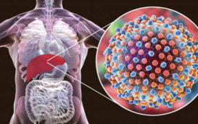 Hepatitis: Here Are Some Early Warning Signs And Symptoms