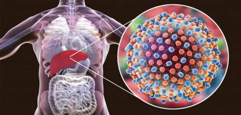 Hepatitis: Here Are Some Early Warning Signs And Symptoms