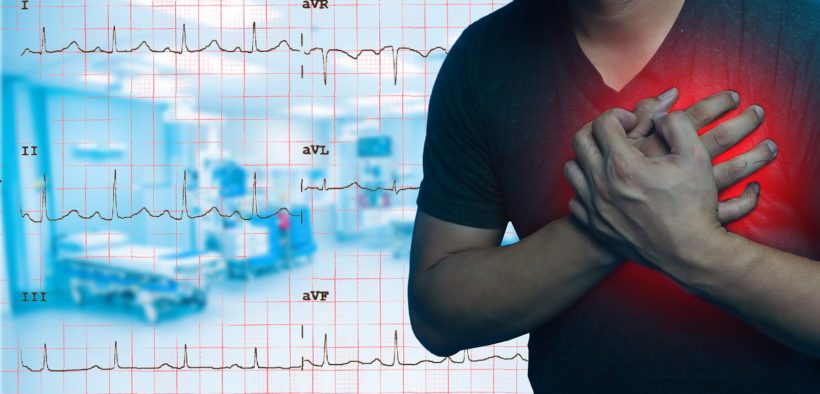 Compared to women, men typically experience CVD at an earlier age