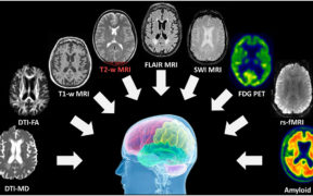 According to a study, neural-network brain scans can boost creativity