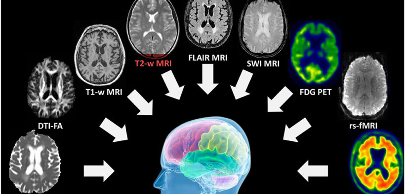 According to a study, neural-network brain scans can boost creativity