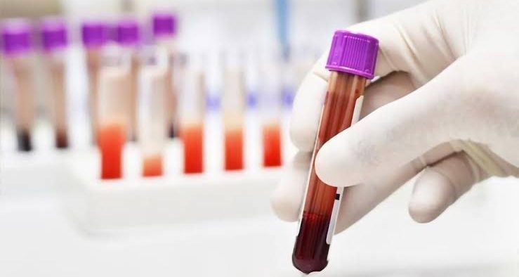 AI Blood Test Rapid Detection of Pancreatic, Gastric, & Colorectal Illnesses
