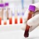 AI Blood Test Rapid Detection of Pancreatic, Gastric, & Colorectal Illnesses