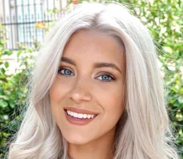 White hair and blue eyes 