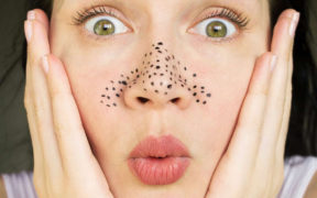 The best and worst ways to remove blackheads