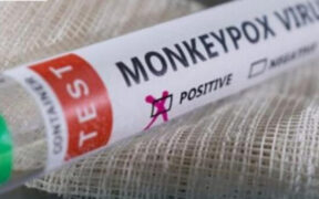 Sharjah Passenger Tests Positive for Monkeypox at Airport